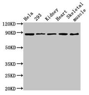 Western Blot Positive WB detected in: Hela whole cell lysate, 293 whole cell lysate, Rat kidney tissue, Mouse heart tissue, Mouse skeletal muscle tissue All lanes: SEMA3A antibody at 3.6µg/ml Secondary Goat polyclonal to rabbit IgG at 1/50000 dilu...
