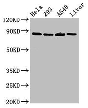 Western Blot Positive WB detected in: Hela whole cell lysate, 293 whole cell lysate, A549 whole cell lysate, Rat liver tissue All lanes: USP10 antibody at 3ug/ml Secondary Goat polyclonal to rabbit IgG at 1/50000 dilution Predicted band size: 88,...