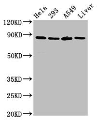 Western Blot Positive WB detected in: Hela whole cell lysate, 293 whole cell lysate, A549 whole cell lysate, Rat liver tissue All lanes: USP10 antibody at 3ug/ml Secondary Goat polyclonal to rabbit IgG at 1/50000 dilution Predicted band size: 88,...