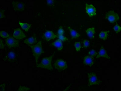 Immunofluorescence staining of SH-SY5Y cells with CSB-PA613519LA01HU at 1:50, counter-stained with DAPI. The cells were fixed in 4% formaldehyde, permeabilized using 0.2% Triton X-100 and blocked in 10% normal Goat Serum. The cells were then incub...