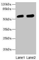 Western blot All lanes: CBX2 antibody at 6µg/ml Lane 1: A431 whole cell lysate Lane 2: Mouse heart tissue Secondary Goat polyclonal to rabbit IgG at 1/10000 dilution Predicted band size: 57, 24 kDa Observed band size: 57 kDa