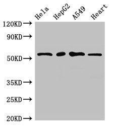 Western Blot Positive WB detected in: Hela whole cell lysate, HepG2 whole cell lysate, A549 whole cell lysate, Mouse heart tissue All lanes: MEF2D antibody at 2.7µg/ml Secondary Goat polyclonal to rabbit IgG at 1/50000 dilution Predicted band size...