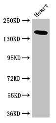 Western Blot Positive WB detected in: Mouse heart tissue All lanes: MYBPC-3 antibody at 2.5ug/ml Secondary Goat polyclonal to rabbit IgG at 1/50000 dilution Predicted band size: 141 kDa Observed band size: 141 kDa