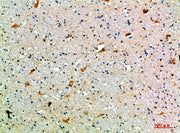 Immunohistochemical analysis of paraffin-embedded human-brain, antibody was diluted at 1:200