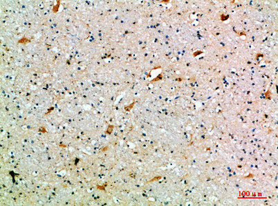 Immunohistochemical analysis of paraffin-embedded human-brain, antibody was diluted at 1:200