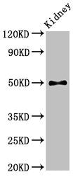 Western Blot Positive WB detected in: Mouse kidney tissue All lanes: PDK1 antibody at 2.8ug/ml Secondary Goat polyclonal to rabbit IgG at 1/50000 dilution Predicted band size: 50, 52 kDa Observed band size: 50 kDa