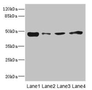 Western blot All lanes: PDK3 antibody at 1.6µg/ml Lane 1: Mouse kidney tissue Lane 2: RAW264.7 whole cell lysate Lane 3: A431 whole cell lysate Lane 4: HepG2 whole cell lysate Secondary Goat polyclonal to rabbit IgG at 1/10000 dilution Predicted b...