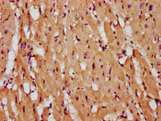 IHC image of CSB-PA613588LA01HU diluted at 1:400 and staining in paraffin-embedded human heart tissue performed on a Leica BondTM system. After dewaxing and hydration, antigen retrieval was mediated by high pressure in a citrate buffer (pH 6.0). S...