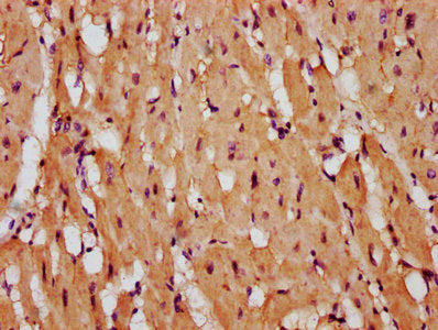 IHC image of CSB-PA613588LA01HU diluted at 1:400 and staining in paraffin-embedded human heart tissue performed on a Leica BondTM system. After dewaxing and hydration, antigen retrieval was mediated by high pressure in a citrate buffer (pH 6.0). S...