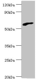 Western blot All lanes: RBBP5 antibody at 6µg/ml + HepG2 whole cell lysate Secondary Goat polyclonal to rabbit IgG at 1/10000 dilution Predicted band size: 60, 56 kDa Observed band size: 60 kDa