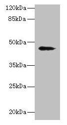 Western blot All lanes: RBMS2 antibody at 0.5µg/ml + MCF-7 whole cell lysate Secondary Goat polyclonal to rabbit IgG at 1/10000 dilution Predicted band size: 44 kDa Observed band size: 44 kDa