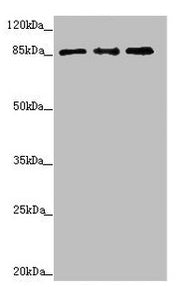Western blot All lanes: TAF5 antibody at 2.33µg/ml Lane 1: Hela whole cell lysate Lane 2: HepG2 whole cell lysate Lane 3: MCF-7 whole cell lysate Secondary Goat polyclonal to rabbit IgG at 1/10000 dilution Predicted band size: 87, 81 kDa Observed...