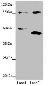 Western blot All lanes: TAF5 antibody at 1.74 ug/ml Lane 1: Jurkat whole cell lysate Lane 2: MCF-7 whole cell lysate Secondary Goat polyclonal to rabbit IgG at 1/10000 dilution Predicted band size: 87, 81 kDa Observed band size: 87, 40, 51 kDa