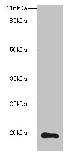 Western blot All lanes: RAB30 antibody at 1µg/ml + Hela whole cell lysate Secondary Goat polyclonal to rabbit IgG at 1/10000 dilution Predicted band size: 24, 19 kDa Observed band size: 19 kDa