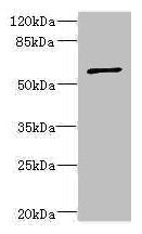Western blot All lanes: TBCE antibody at 5.55µg/ml + CEM whole cell lysate Secondary Goat polyclonal to rabbit IgG at 1/10000 dilution Predicted band size: 60, 65 kDa Observed band size: 60 kDa