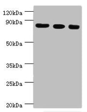 Western blot All lanes: Histone-lysine N-methyltransferase EZH2 antibody at 12ug/ml Lane 1: A431 whole cell lysate Lane 2: Jurkat whole cell lysate Lane 3: Mouse kidney tissue Secondary Goat polyclonal to rabbit IgG at 1/10000 dilution Predicted b...