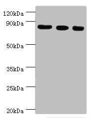 Western blot All lanes: Histone-lysine N-methyltransferase EZH2 antibody at 12ug/ml Lane 1: A431 whole cell lysate Lane 2: Jurkat whole cell lysate Lane 3: Mouse kidney tissue Secondary Goat polyclonal to rabbit IgG at 1/10000 dilution Predicted b...