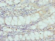 Immunohistochemistry of paraffin-embedded human colon tissue using CSB-PA613670DSR1HU at dilution of 1:100