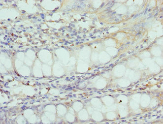 Immunohistochemistry of paraffin-embedded human colon tissue using CSB-PA613670DSR1HU at dilution of 1:100