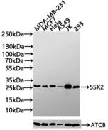 Western blot All lanes: Protein SSX2 antibody at 2ug/ml + MDA-MB-231 whole cell lysate Secondary Goat polyclonal to rabbit IgG at 1/10000 dilution Predicted band size: 22, 26 kDa Observed band size: 22 kDa