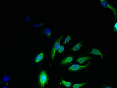 Immunofluorescent analysis of Hela cells using CSB-PA613690LA01HU at dilution of 1:100 and Alexa Fluor 488-congugated AffiniPure Goat Anti-Rabbit IgG(H+L)