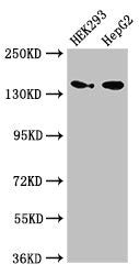 Western Blot Positive WB detected in: HEK293 whole cell lysate, HepG2 whole cell lysate All lanes: MAN2A1 antibody at 3.5ug/ml Secondary Goat polyclonal to rabbit IgG at 1/50000 dilution Predicted band size: 132 kDa Observed band size: 150 kDa