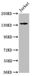 Western Blot Positive WB detected in: Jurkat whole cell lysate All lanes: ATP2B3 antibody at 1:500 Secondary Goat polyclonal to rabbit IgG at 1/50000 dilution Predicted band size: 135, 129, 128, 133, 127, 125, 123 kDa Observed band size: 135 kDa