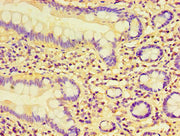 Immunohistochemistry of paraffin-embedded human small intestine tissue using CSB-PA613699LA01HU at dilution of 1:100