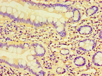 Immunohistochemistry of paraffin-embedded human small intestine tissue using CSB-PA613699LA01HU at dilution of 1:100