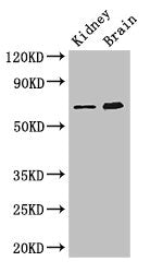 Western Blot Positive WB detected in: Mouse kidney tissue, Mouse brain tissue All lanes: ME3 antibody at 3ug/ml Secondary Goat polyclonal to rabbit IgG at 1/50000 dilution Predicted band size: 68, 39 kDa Observed band size: 68 kDa