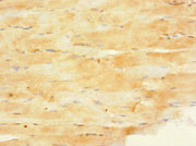 Immunohistochemistry of paraffin-embedded human skeletal muscle tissue using CSB-PA613701DSR1HU at dilution of 1:100