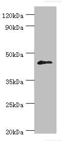 Western blot All lanes: Dual specificity protein phosphatase 7 antibody at 10ug/ml + HepG2 whole cell lysate Secondary Goat polyclonal to rabbit IgG at 1/10000 dilution Predicted band size: 45, 41 kDa Observed band size: 45 kDa