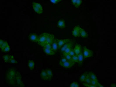 Immunofluorescence staining of HepG2 cells with CSB-PA613704LA01HU at 1:200, counter-stained with DAPI. The cells were fixed in 4% formaldehyde, permeabilized using 0.2% Triton X-100 and blocked in 10% normal Goat Serum. The cells were then incuba...