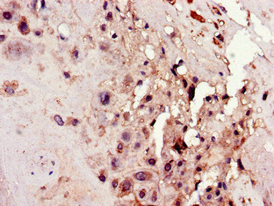 Immunohistochemistry of paraffin-embedded human placenta tissue using CSB-PA613780LA01HU at dilution of 1:100