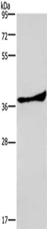 Gel: 8%SDS-PAGE,Lysate: 40 ug,,Primary antibody: CSB-PA614186(PRKAG1 Antibody) at dilution 1/300 dilution,Secondary antibody: Goat anti rabbit IgG at 1/8000 dilution,Exposure time: 20 seconds