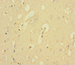Immunohistochemistry of paraffin-embedded human brain tissue using CSB-PA614255LA01HU at dilution of 1:100
