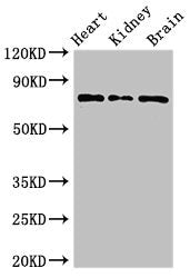 Western Blot Positive WB detected in: Mouse heart tissue, Mouse kidney tissue, Mouse brain tissue All lanes: OVGP1 antibody at 3ug/ml Secondary Goat polyclonal to rabbit IgG at 1/50000 dilution Predicted band size: 76 kDa Observed band size: 76 kDa