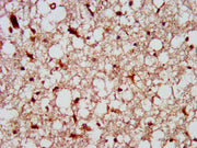 IHC image of CSB-PA614263LA01HU diluted at 1:300 and staining in paraffin-embedded human brain tissue performed on a Leica BondTM system. After dewaxing and hydration, antigen retrieval was mediated by high pressure in a citrate buffer (pH 6.0). S...