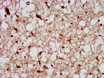 IHC image of CSB-PA614263LA01HU diluted at 1:300 and staining in paraffin-embedded human brain tissue performed on a Leica BondTM system. After dewaxing and hydration, antigen retrieval was mediated by high pressure in a citrate buffer (pH 6.0). S...