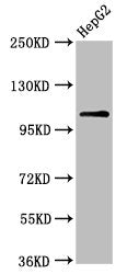 Western Blot Positive WB detected in: HepG2 whole cell lysate All lanes: USP4 antibody at 6.3µg/ml Secondary Goat polyclonal to rabbit IgG at 1/50000 dilution Predicted band size: 109, 104, 36 kDa Observed band size: 109 kDa