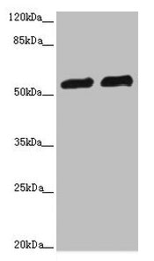 Western blot All lanes: CALCOCO2 antibody at 3.36ug/ml Lane 1: Hela whole cell lysate Lane 2: Raji whole cell lysate Secondary Goat polyclonal to rabbit IgG at 1/10000 dilution Predicted band size: 53, 48, 55, 56, 44 kDa Observed band size: 56 kDa