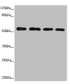 Western blot All lanes: CALCOCO2 antibody at 3.66ug/ml Lane 1: Hela whole cell lysate Lane 2: Jurkat whole cell lysate Lane 3: 293T whole cell lysate Lane 4: Raji whole cell lysate Secondary Goat polyclonal to rabbit IgG at 1/10000 dilution Predic...