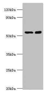 Western blot All lanes: STK3 antibody at 8µg/ml Lane 1: Hela whole cell lysate Lane 2: NIH/3T3 whole cell lysate Secondary Goat polyclonal to rabbit IgG at 1/10000 dilution Predicted band size: 57, 60 kDa Observed band size: 57 kDa