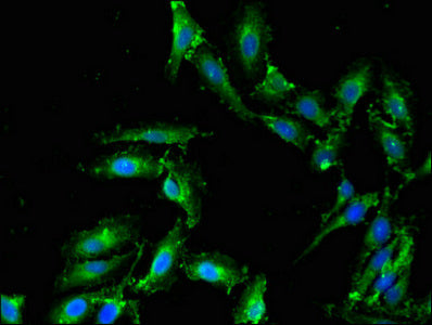 Immunofluorescent analysis of Hela cells using CSB-PA614406LA01HU at dilution of 1:100 and Alexa Fluor 488-congugated AffiniPure Goat Anti-Rabbit IgG(H+L)