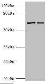 Western blot All lanes: Myotubularin antibody at 2ug/ml Lane 1: Jurkat whole cell lysate Lane 2: HepG2 whole cell lysate Secondary Goat polyclonal to rabbit IgG at 1/10000 dilution Predicted band size: 70, 67 kDa Observed band size: 70 kDa