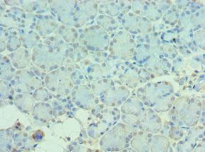 Immunohistochemistry of paraffin-embedded human pancreatic tissue using CSB-PA614418ESR2HU at dilution of 1:100