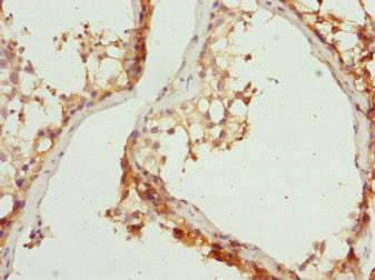 Immunohistochemistry of paraffin-embedded human testis tissue using CSB-PA614438ESR2HU at dilution of 1:100