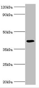 Western blot All lanes: Alkylated DNA repair protein alkB homolog 1 antibody at 9ug/ml + Mouse kidney tissue Secondary Goat polyclonal to rabbit IgG at 1/10000 dilution Predicted band size: 44 kDa Observed band size: 44 kDa