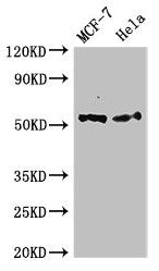 Western Blot Positive WB detected in: MCF-7 whole cell lysate, Hela whole cell lysate All lanes: PTK6 antibody at 2.4µg/ml Secondary Goat polyclonal to rabbit IgG at 1/50000 dilution Predicted band size: 52, 15 kDa Observed band size: 52 kDa