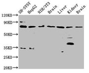 Western Blot Positive WB detected in: SH-SY5Y whole cell lysate, HepG2 whole cell lysate, NIH/3T3 whole cell lysate, Rat brain tissue, Rat liver tissue, Rat kidney tissue, Mouse brain tissue All lanes: CUX1 antibody at 3.7µg/ml Secondary Goat poly...